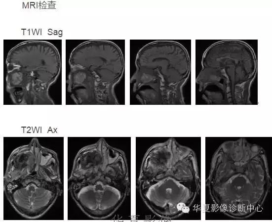 这些部位的黑色素瘤，您会诊断吗？