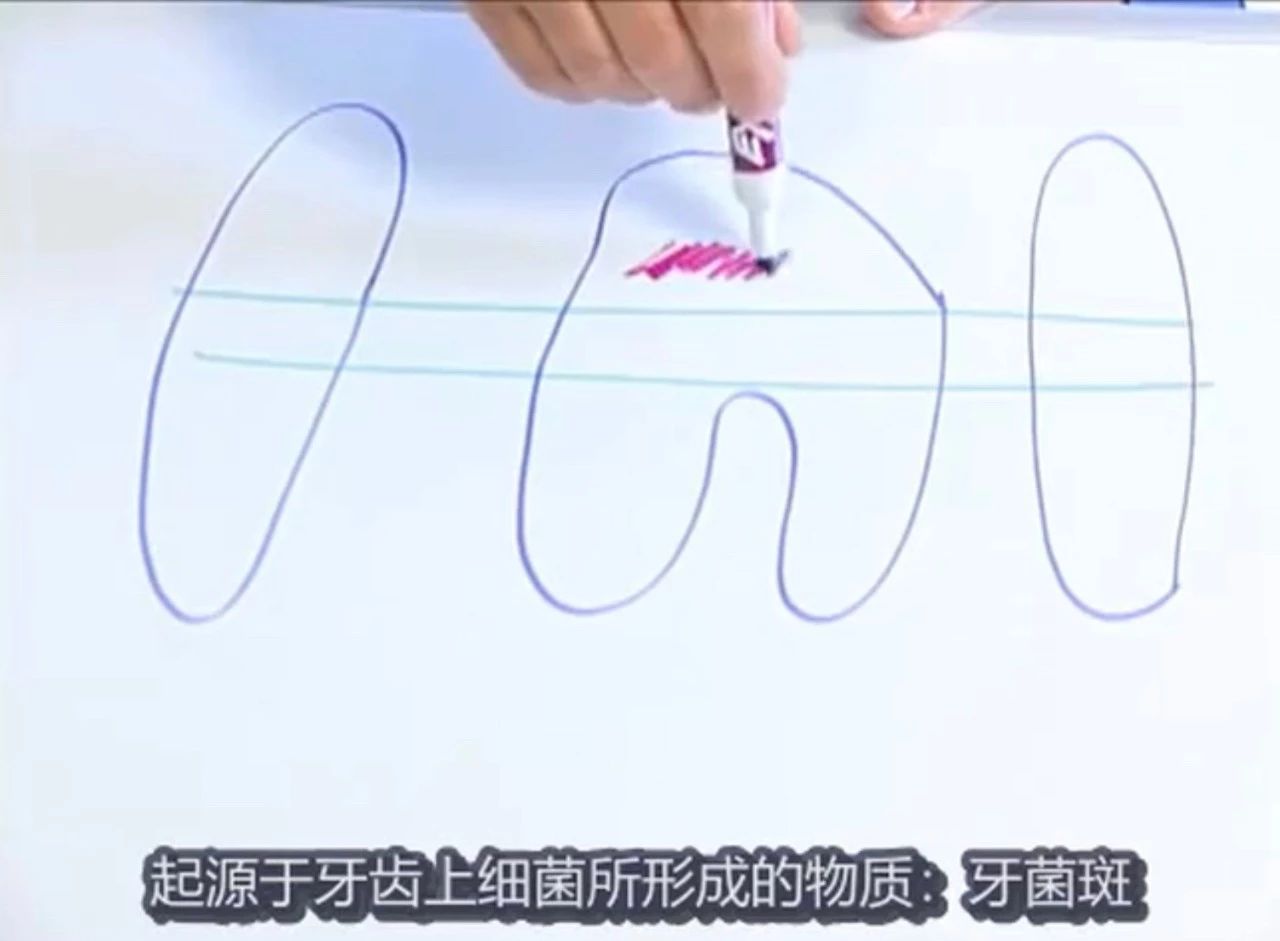 猫怎么刷牙正确方法,猫不想刷牙什么东西可以给猫刷牙