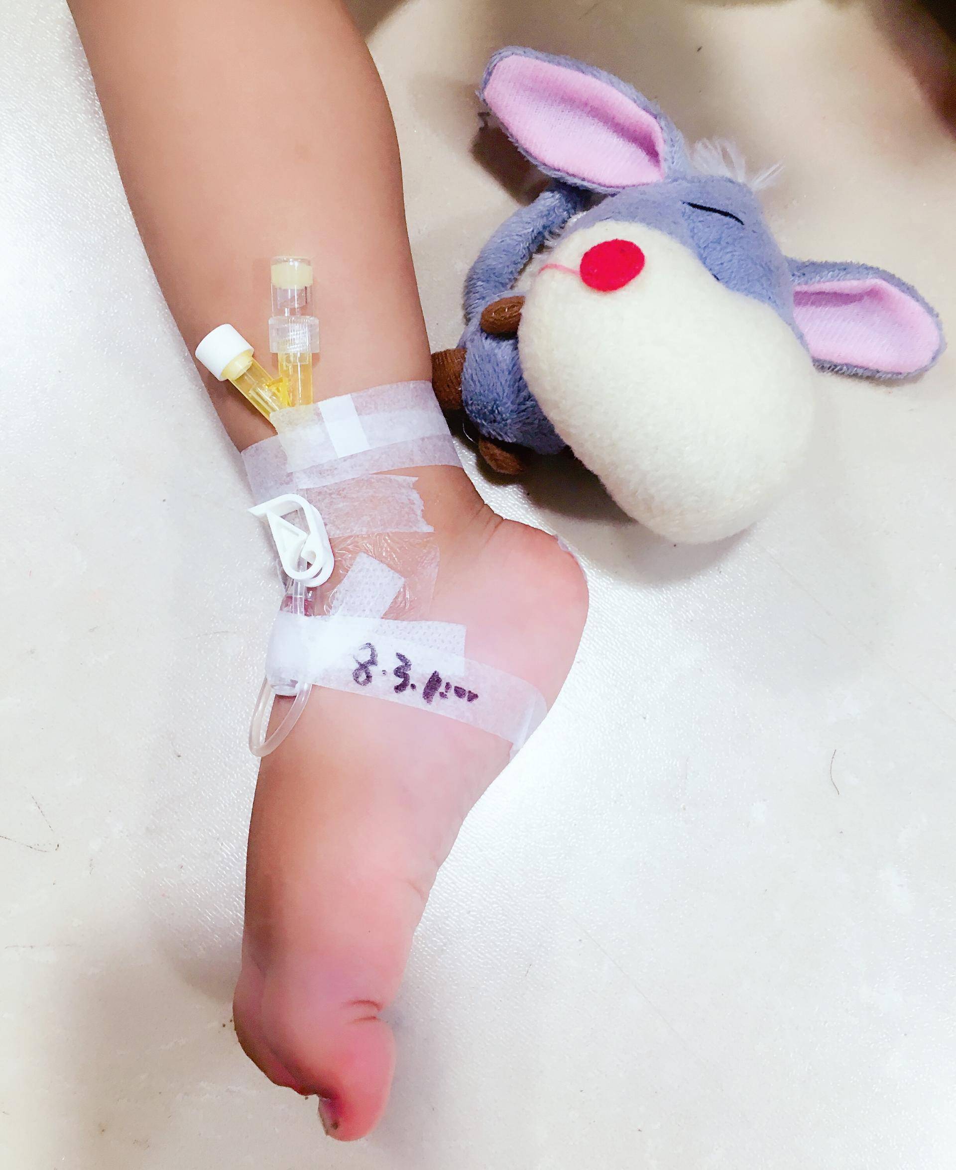 宝宝怎么保护留置针,静脉留置针的使用护理ppt