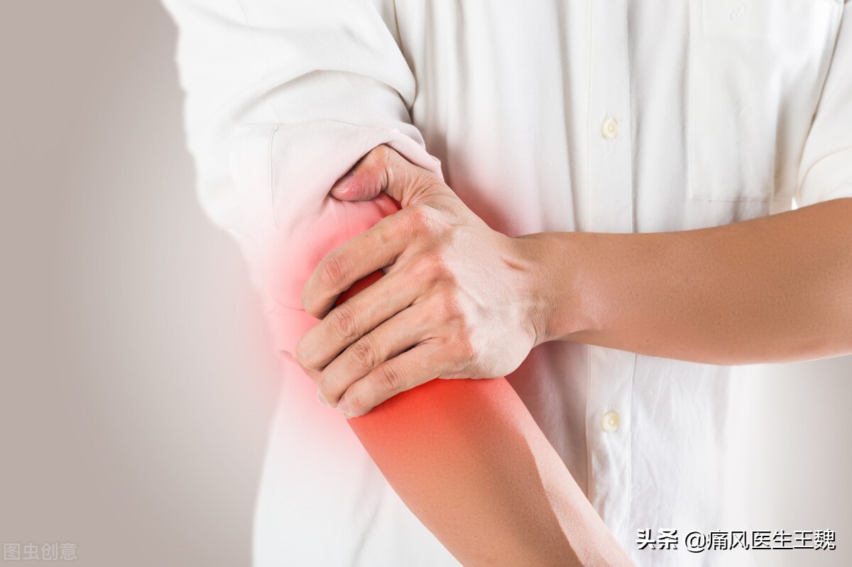 痛风发作期间什么症状表示快好了,痛风主要迹象