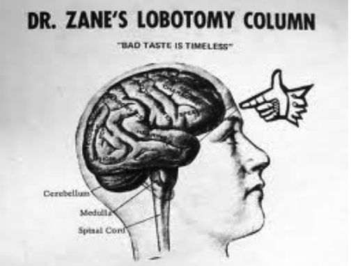 肯尼迪家族“隐身女孩”：美丽而有智力缺陷，23岁接受“脑切除”
