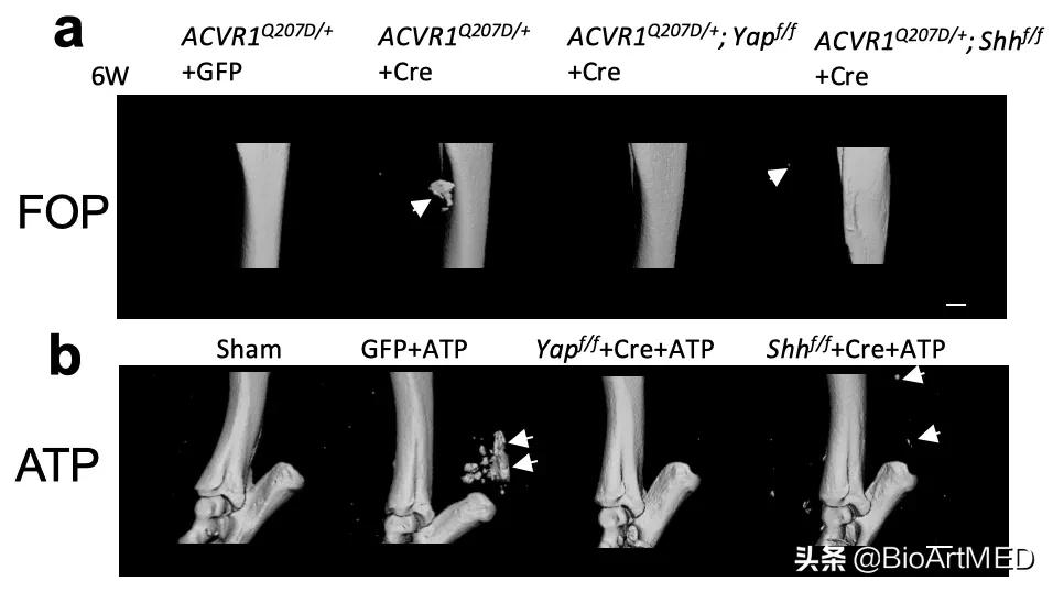进展|哈佛华人教授团队揭示异位骨化形成及扩展的新机制​