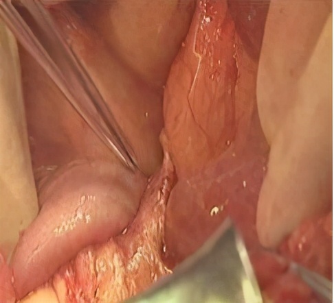 拉不出便便怎么办,拉不出便便怎么办该买什么