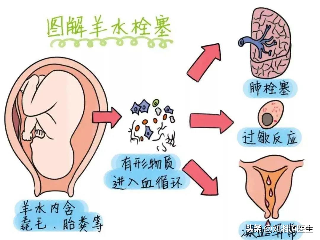 免疫治疗不良反应科普图文,免疫因素怀孕早期保胎几率大吗