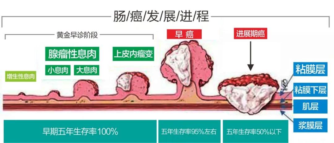 41岁男子屁股痒，以为痔疮忍10年，做肠镜后医生：肛门可能保不住