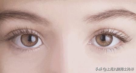 内双怎么变双眼皮整形手术多少钱,内双双眼皮适合哪种手术