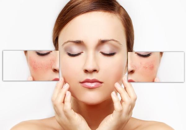 敏感肌肤的十大误区,敏感性肌肤怎么治疗最好