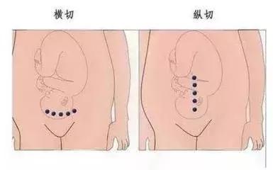 世上最丑的“微笑”，你也曾拥有过？ta令人痛苦、自卑，但伟大！