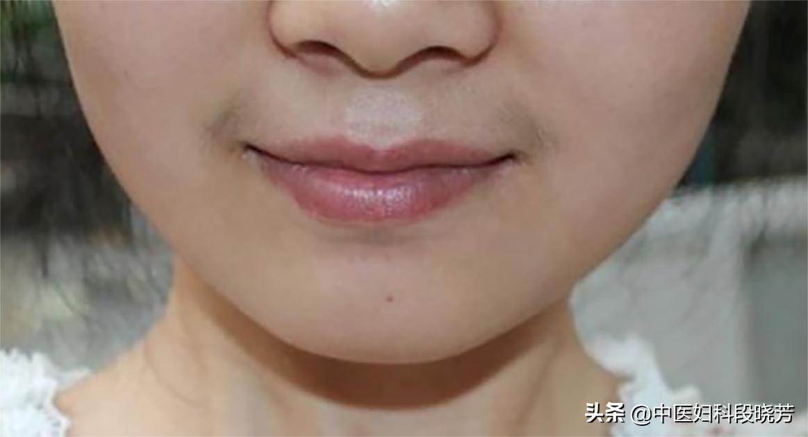 多囊与不孕：卵泡那么多，为啥还难怀孕！段晓芳专家前来解答