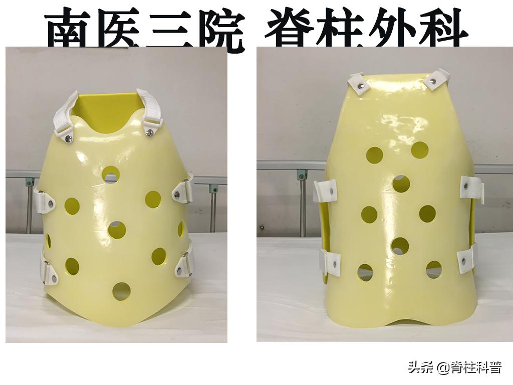 腰痛引起腰椎滑脱怎么治,十七岁腰椎痛怎么办