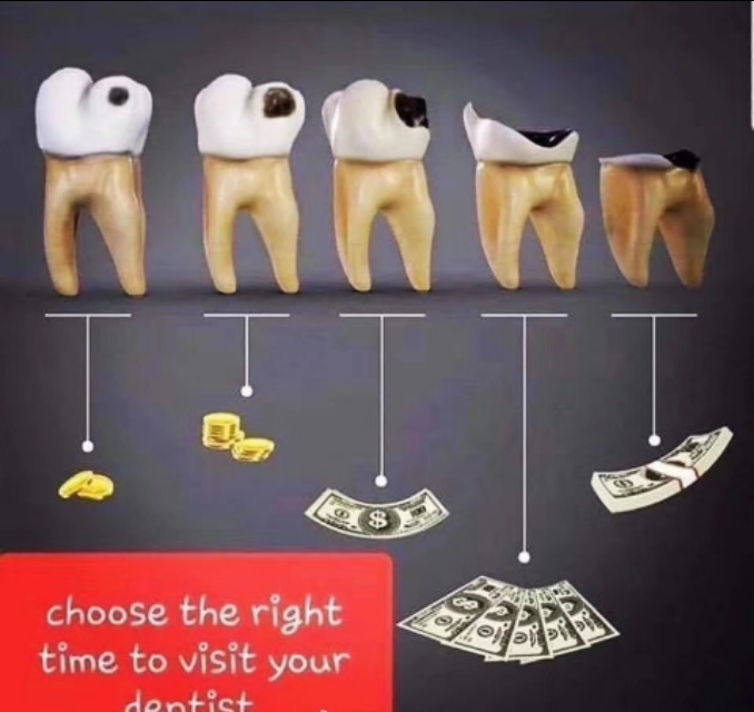 口腔类各项术后注意事项,口腔各种操作后护理注意事项