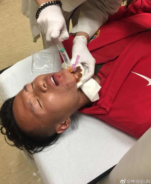 国青c罗,林良铭皇马高光时刻