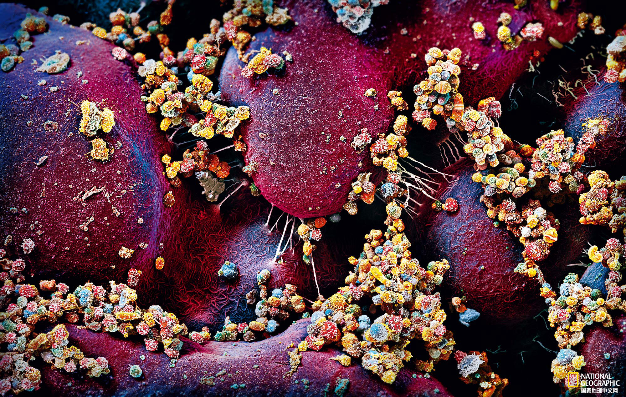 数以兆计的微生物把我们的身体当做家，你了解它们么？