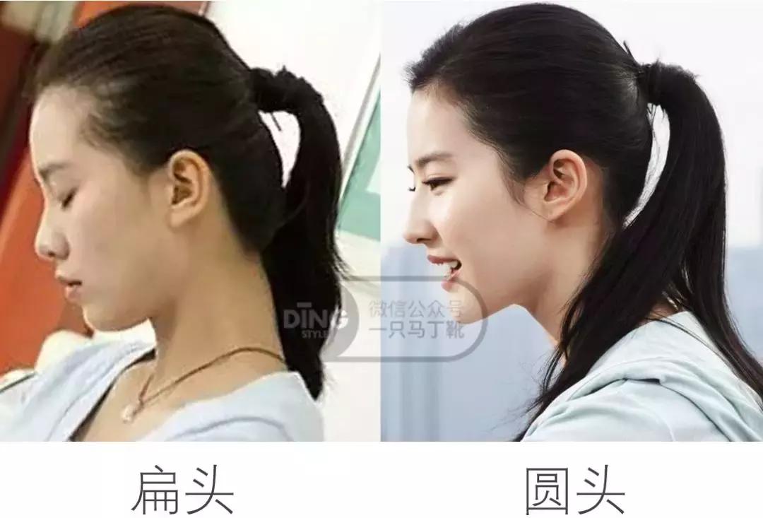 扁头有什么办法改善头型吗,扁头怎么让头变得饱满些