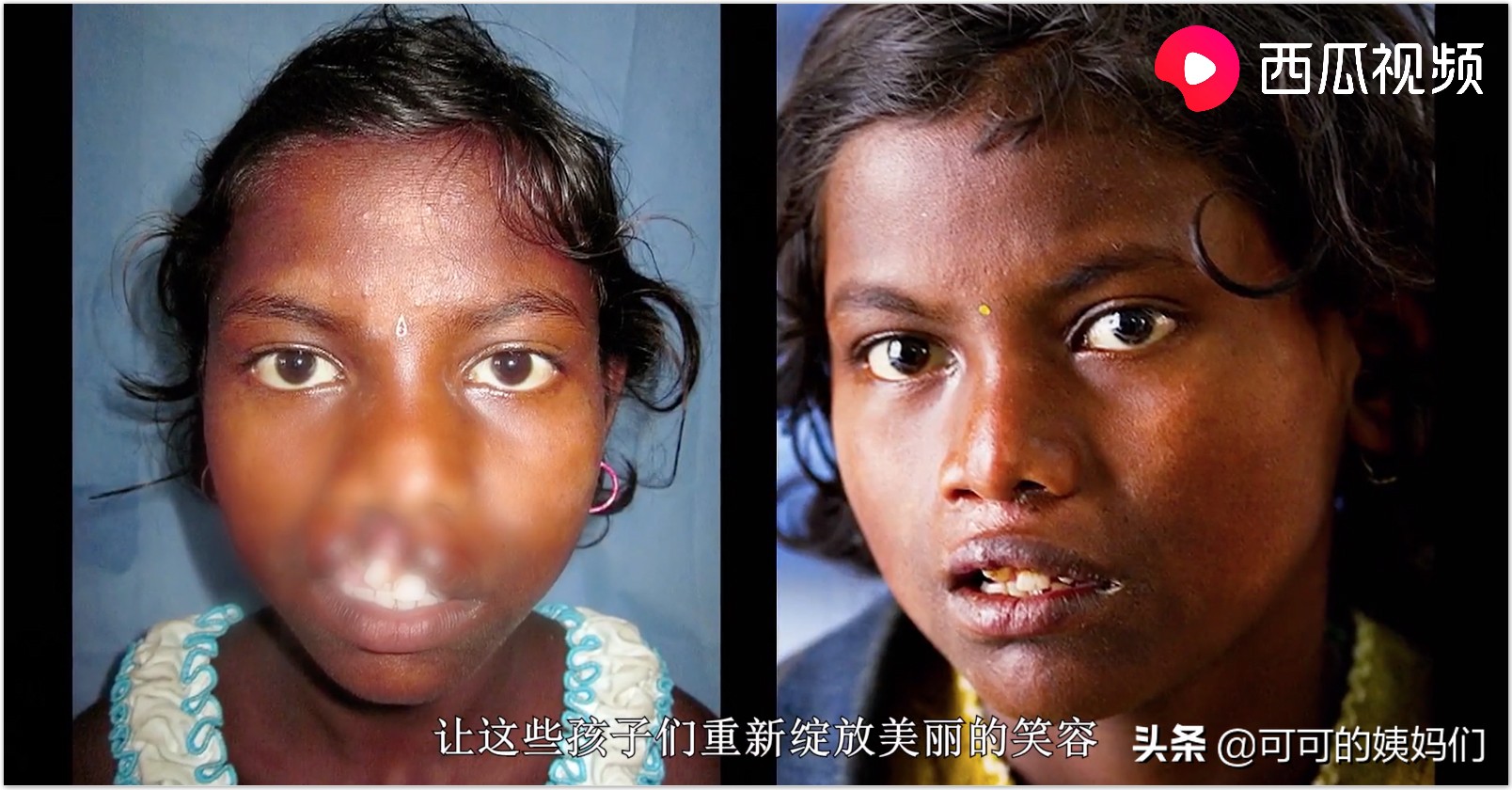 受孕、连体婴、唇裂...西瓜视频揭秘：五大不可思议的繁衍冷知识