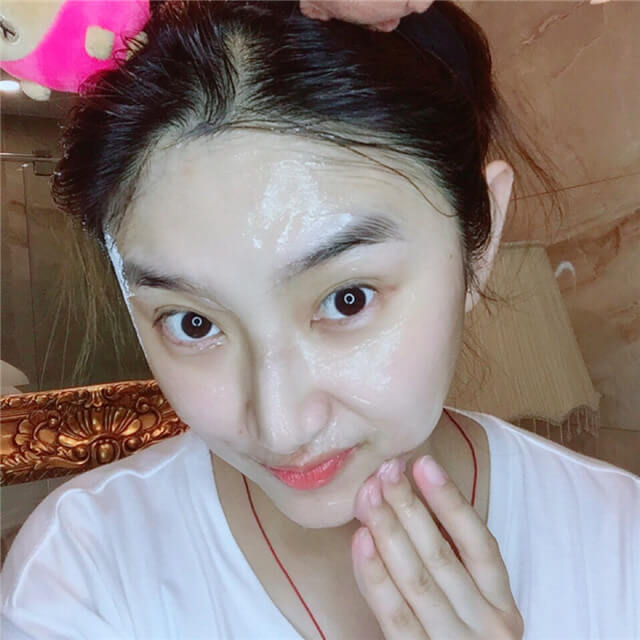 面部毛孔粗大如何改善,面部毛孔粗大如何改善效果最明显