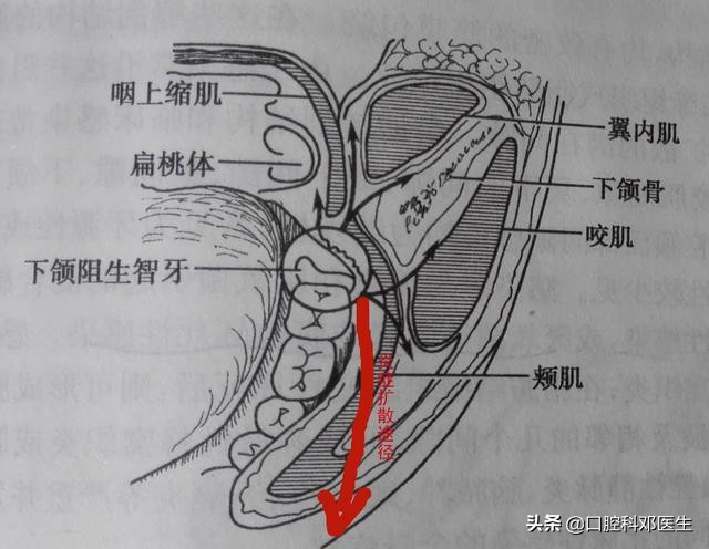 别让一张嘴毁了整张脸,别让一颗牙齿毁了一张脸