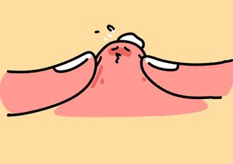 鍋氱編瀹瑰幓姣涘瓟绮夊埡榛戝ご鐥涘悧,鍋氱編瀹圭鐥樺潙