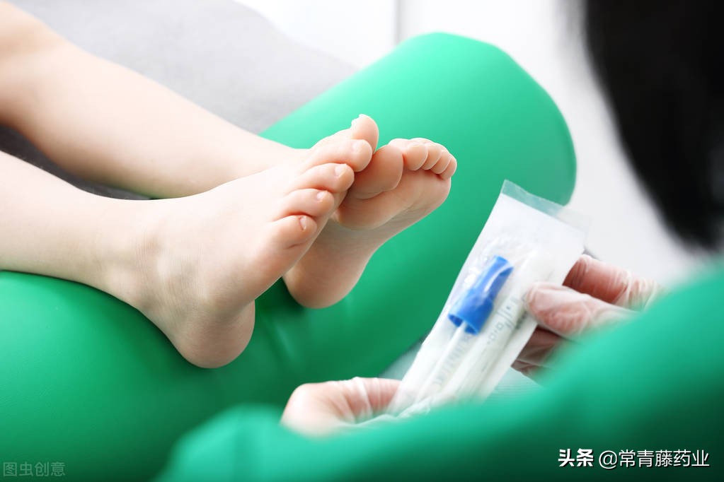 脸上会不会得脚气,脸上有脚气的人