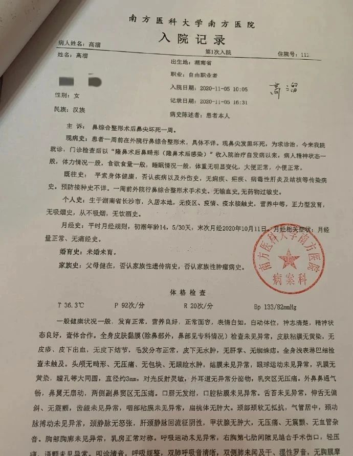 女艺人整容失败有哪个,女演员整容失败变老视频