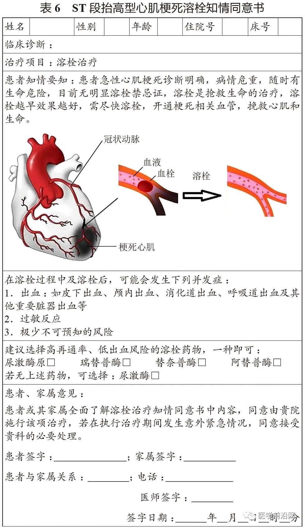 st抬高型心肌梗死溶栓时护理,急性st段抬高型心肌梗死治疗措施