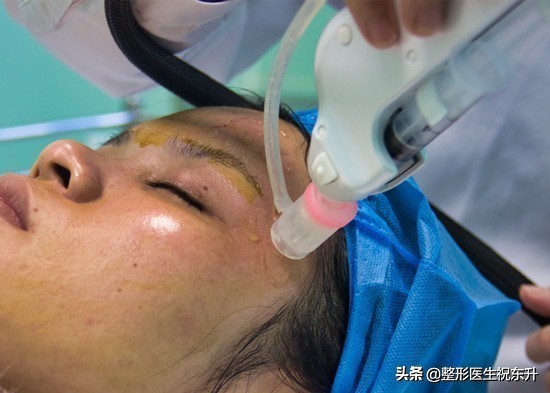 没做过“水光针”的人，听我谈谈真实的感受