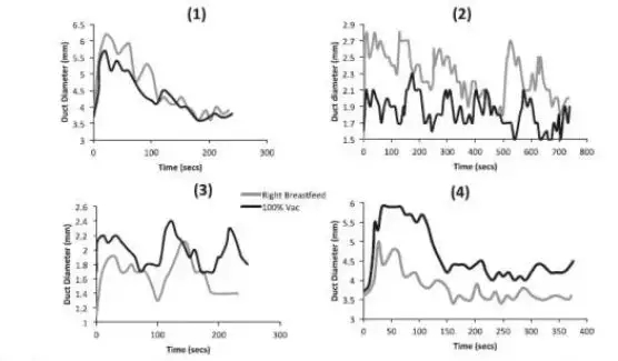 奶水不足如何用吸奶器追奶,泌乳不足