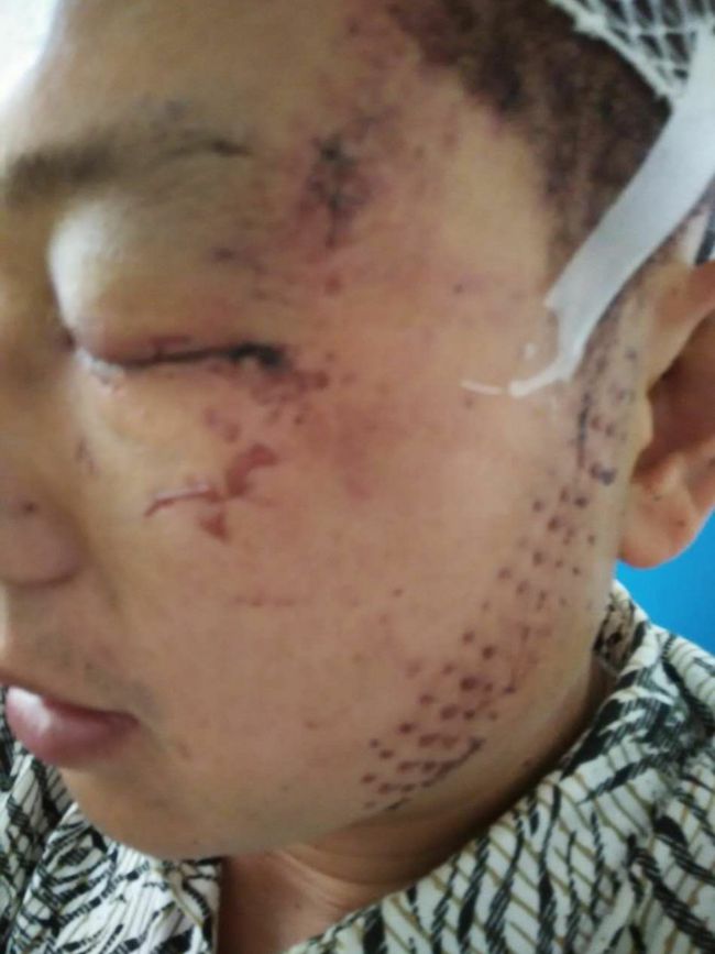 兄弟争宅基地,兄弟争农村宅基地