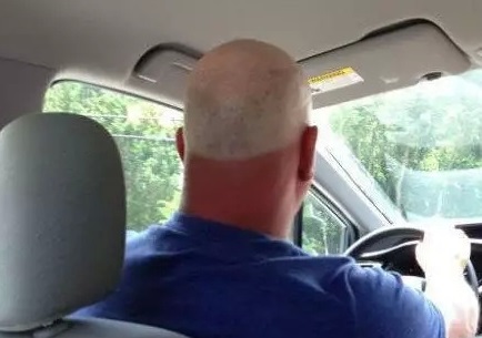 脱发不长发怎么中药治疗,脱发不长头发吃什么好