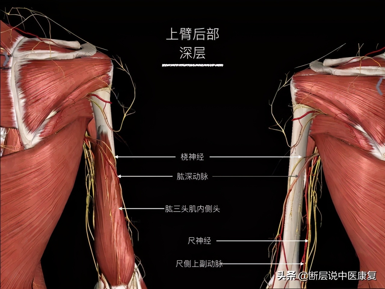 手臂人体解剖图讲解,手臂上举3d肌肉解剖讲解