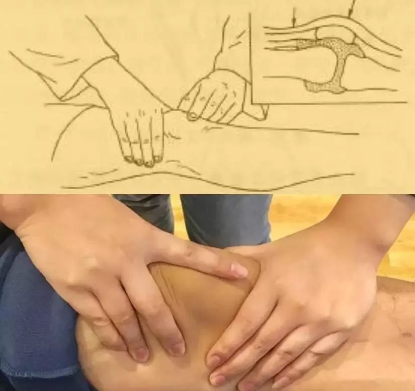 滑膜炎十大常见骨科疾病,骨科专家治滑膜炎偏方