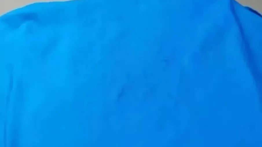 这些都是染色疵病，有图有真相