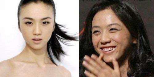 79岁英国一富婆为“除皱”，连打30年玻尿酸抗老，如今长啥样了？