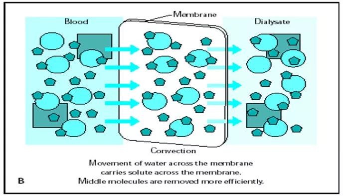 到底是透析好还是换肾好,到底血透好还是腹膜透析好