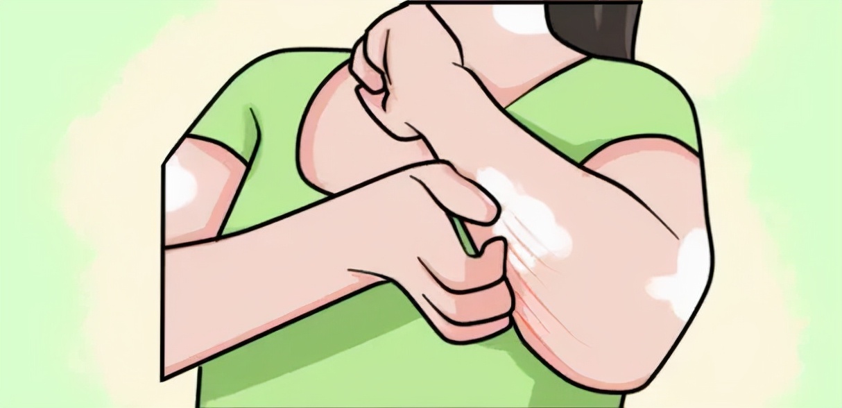 荨麻疹痒的睡不着有什么办法止痒,荨麻疹太痒了可以冷敷吗