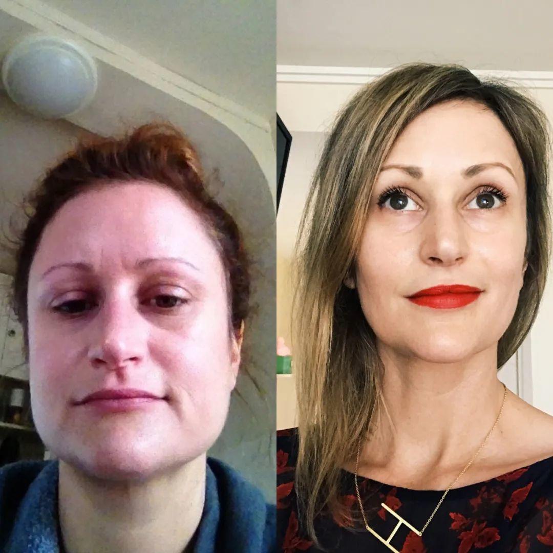 昨晚脸又痛肿了,为什么早上起来感觉脸肿了一圈