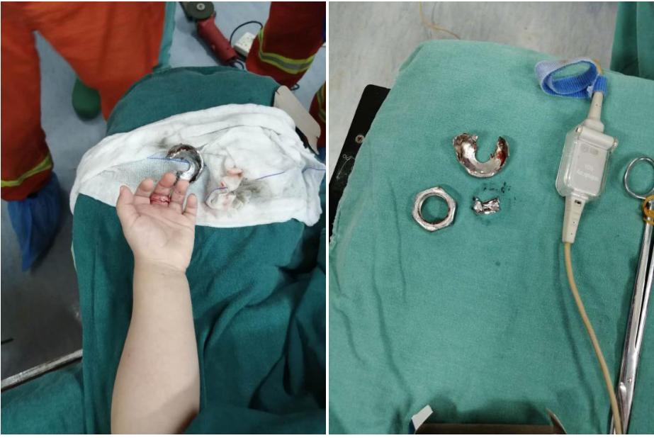 银戒指儿童,银戒指治宝宝惊吓