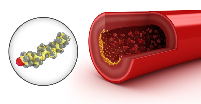 治疗风湿关节炎泡药酒伤肝吗,治疗类风湿性关节炎药不伤肝