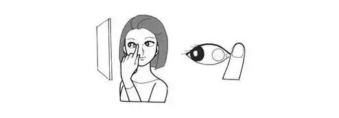 眼科术前宣教,角膜塑形镜住校生怎么戴