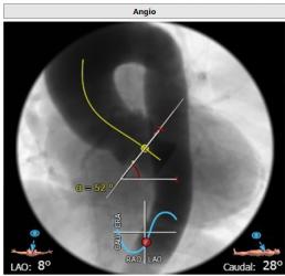 罗建方医生怎么样,罗建方教授