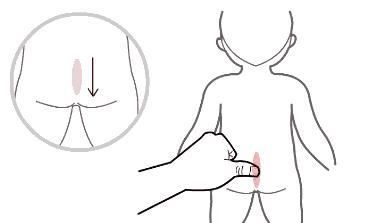 宝宝湿疹反复，中医小儿推拿有什么好方法？