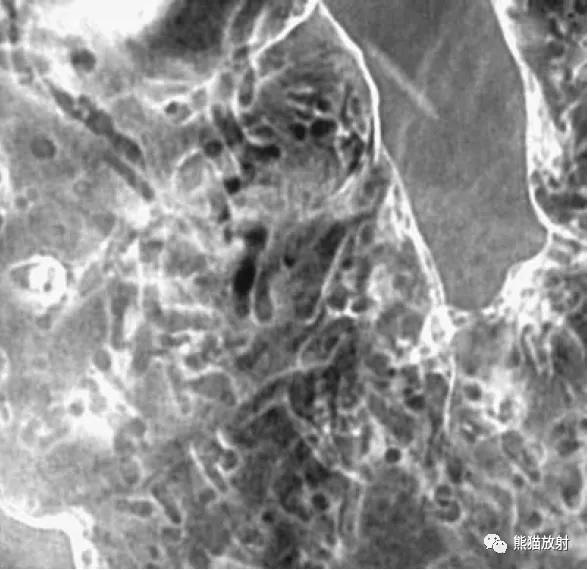 腹部影像图片大全,乙状直肠疼痛位置图片