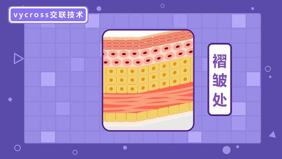 玻尿酸比较好的,好的玻尿酸成分表