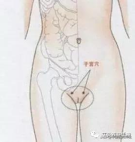 7种妇科问题的艾灸疗法大全,示范一下常用的妇科艾灸选穴
