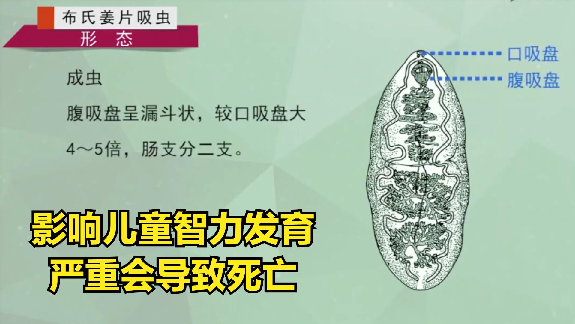 蔬菜中寄生虫的种类和危害,三种蔬菜防止寄生虫