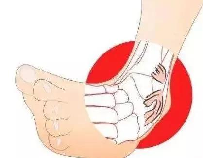 崴脚内踝扭伤,踝关节扭伤是脚崴吗