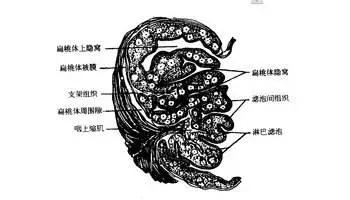 扁桃体容易发炎可以割掉吗,扁桃体老是发炎怎么彻底根治