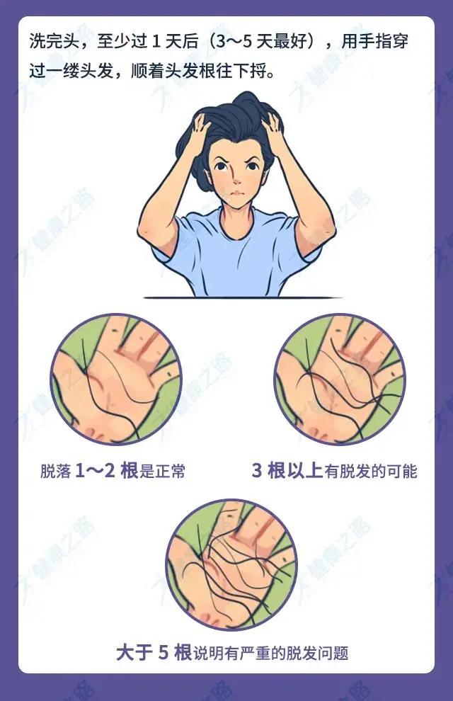 体毛可以移植么,体毛移植到头顶可行吗