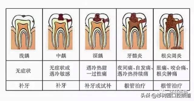 牙疼的滋味没人能理解,牙疼的痛苦有谁能够体会