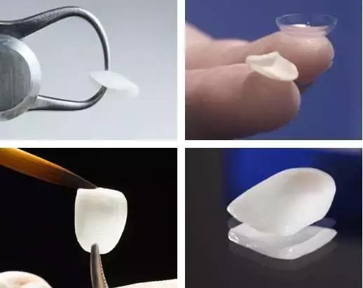 helen鐗欓娇,helen鐗欑涓績鍥剧墖